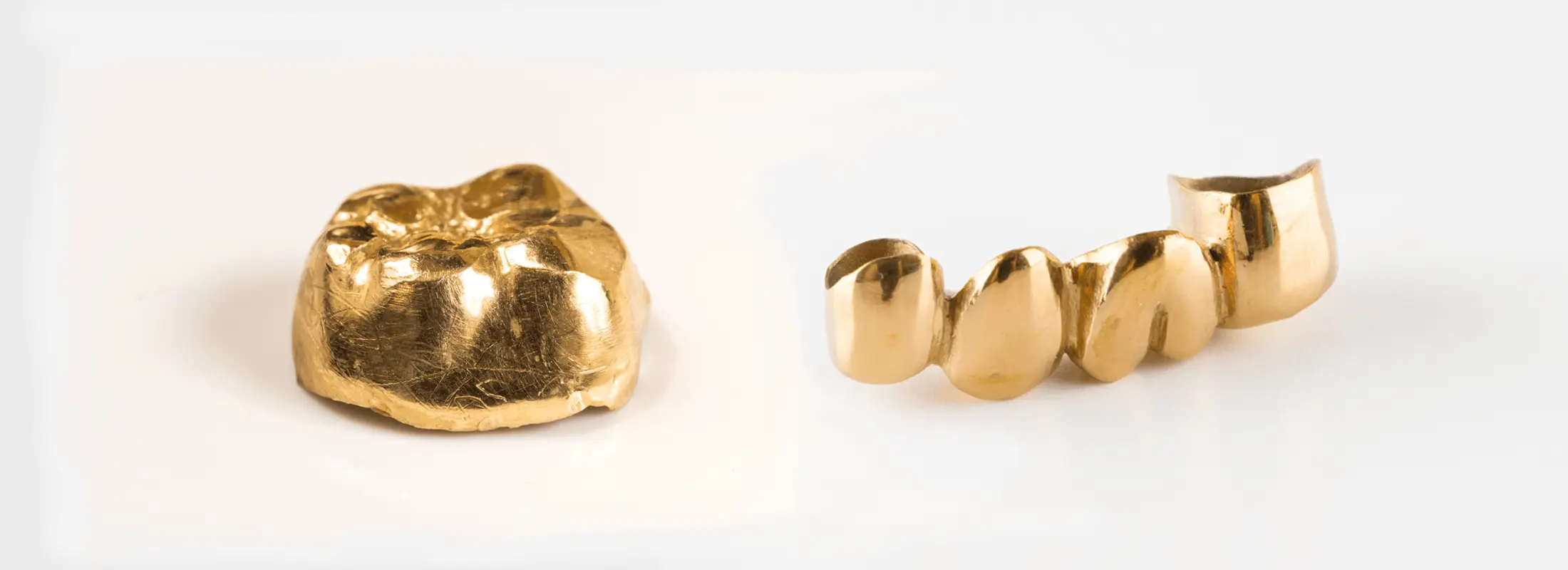 gold tooth and crown