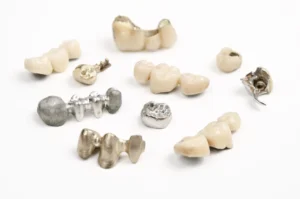 Assorted precious metal dental bridges and gold crowns