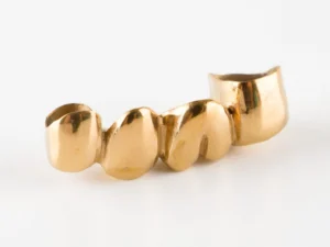 A four-tooth dental gold bridge