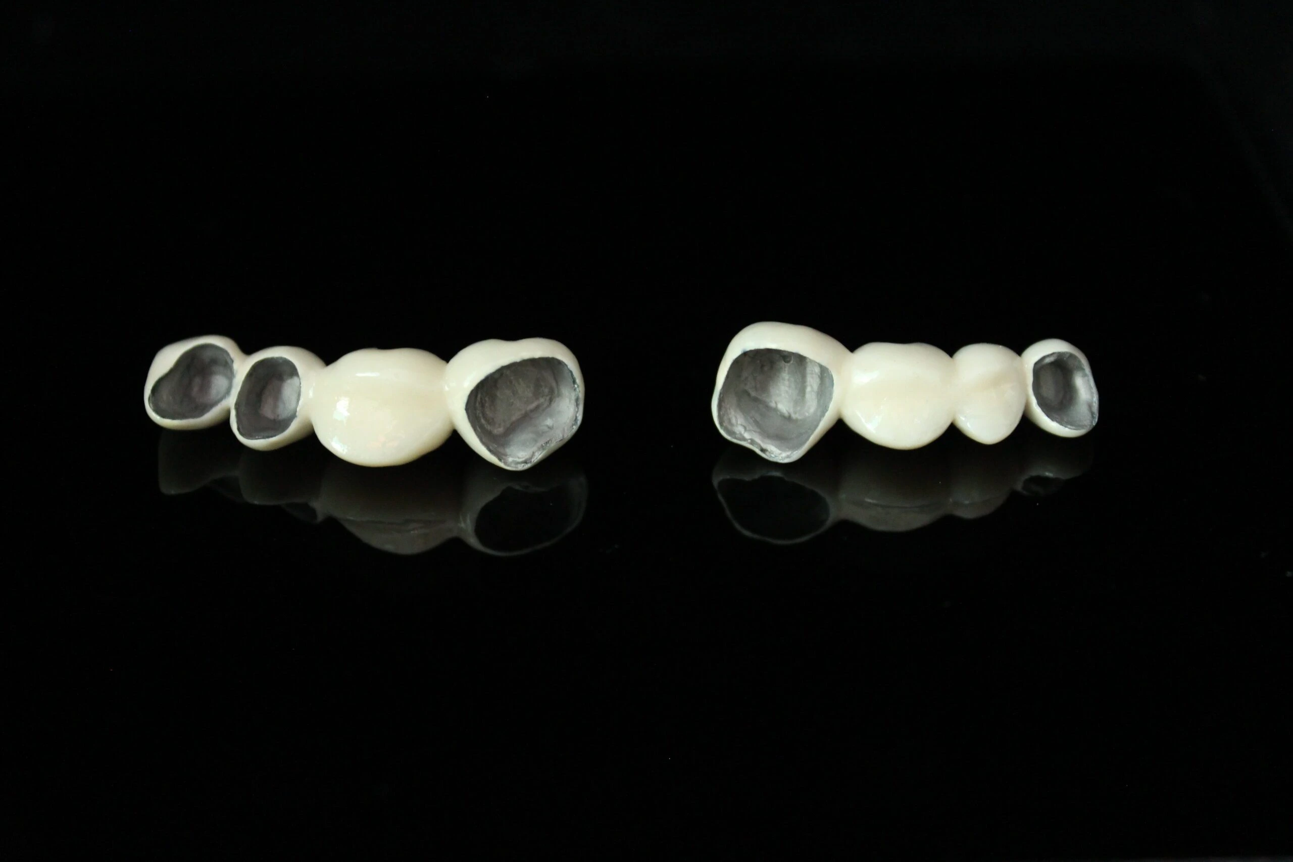 Dental PFM crown and bridge on a black background